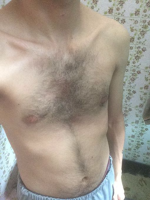 download-2